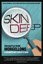 Watch Skin Deep: The Battle Over Morgellons 0123movies