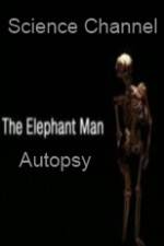 Watch Science Channel Elephant Man Autopsy 0123movies