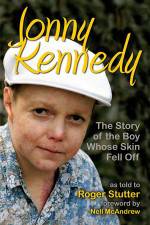 Watch The Boy Whose Skin Fell Off 0123movies