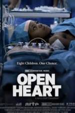 Watch Open Heart 0123movies