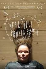 Watch My Beautiful Broken Brain 0123movies