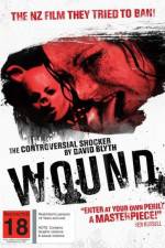 Watch Wound 0123movies