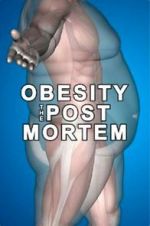 Watch Obesity: The Post Mortem 0123movies