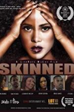 Watch Skinned 0123movies