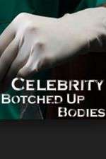 Watch Celebrity Botched Up Bodies 0123movies